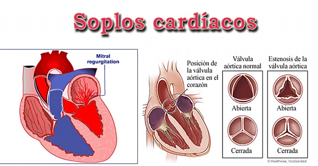 Soplos Card acos Pediatr a Palermo