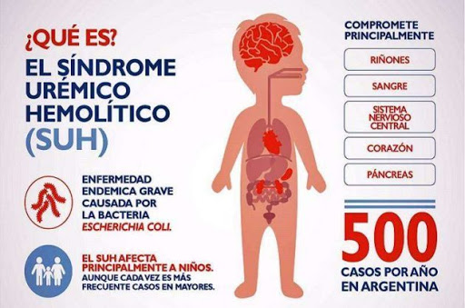 Sindrome Urémico Hemolítico