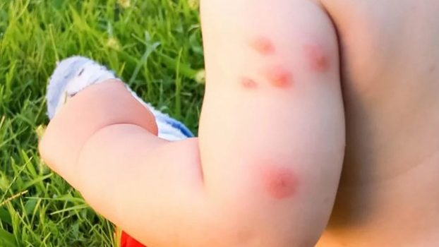 Cuidado de los bebés y recién nacidos frente a los mosquitos